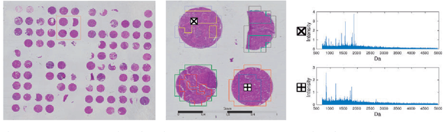 Figure 1 for Deep Learning for Tumor Classification in Imaging Mass Spectrometry