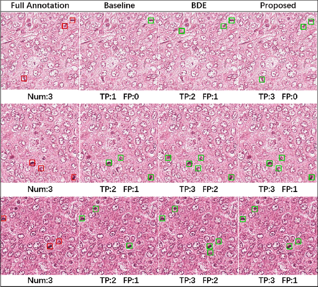 Figure 1 for Positive-unlabeled Learning for Cell Detection in Histopathology Images with Incomplete Annotations