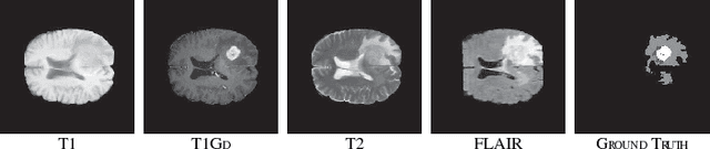 Figure 3 for RA-UNet: A hybrid deep attention-aware network to extract liver and tumor in CT scans