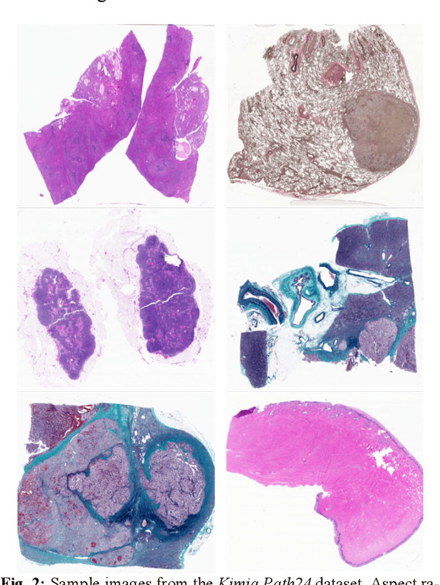 Figure 3 for Deep Barcodes for Fast Retrieval of Histopathology Scans