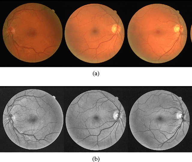 Figure 1 for A Fully Convolutional Neural Network based Structured Prediction Approach Towards the Retinal Vessel Segmentation