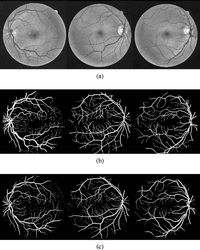 Figure 4 for A Fully Convolutional Neural Network based Structured Prediction Approach Towards the Retinal Vessel Segmentation