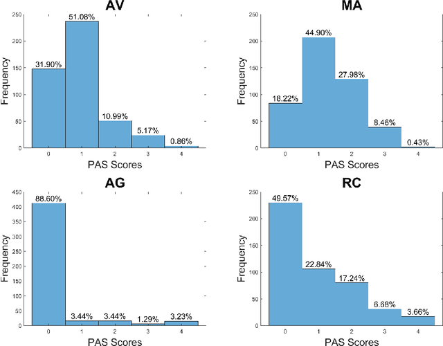 Figure 1 for Tracking agitation in people living with dementia in a care environment