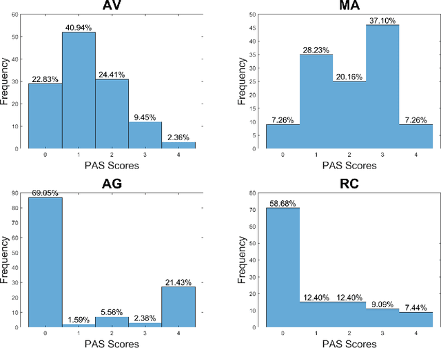 Figure 3 for Tracking agitation in people living with dementia in a care environment