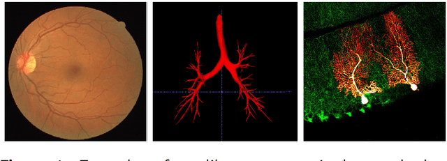 Figure 1 for Human Treelike Tubular Structure Segmentation: A Comprehensive Review and Future Perspectives