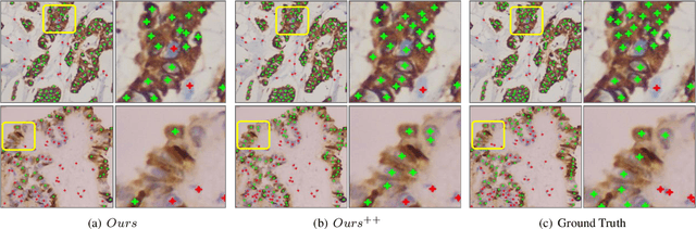 Figure 3 for Weakly Supervised Learning for cell recognition in immunohistochemical cytoplasm staining images