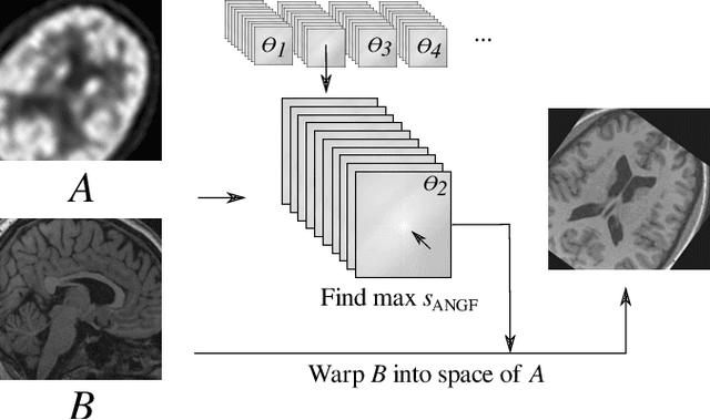 Figure 1 for Cross-Sim-NGF: FFT-Based Global Rigid Multimodal Alignment of Image Volumes using Normalized Gradient Fields
