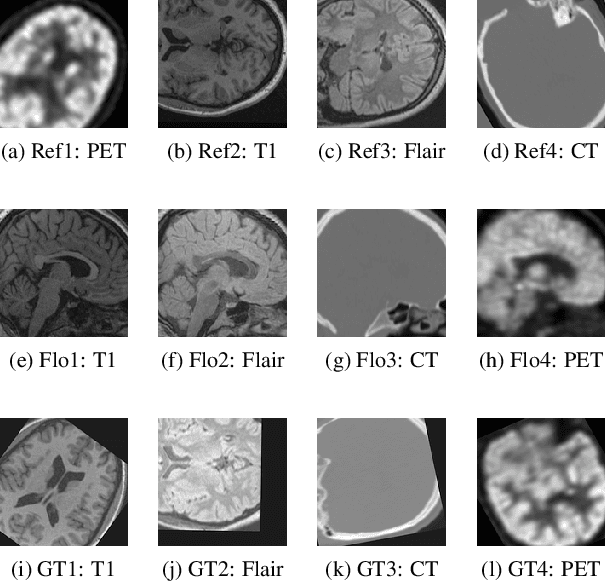 Figure 3 for Cross-Sim-NGF: FFT-Based Global Rigid Multimodal Alignment of Image Volumes using Normalized Gradient Fields