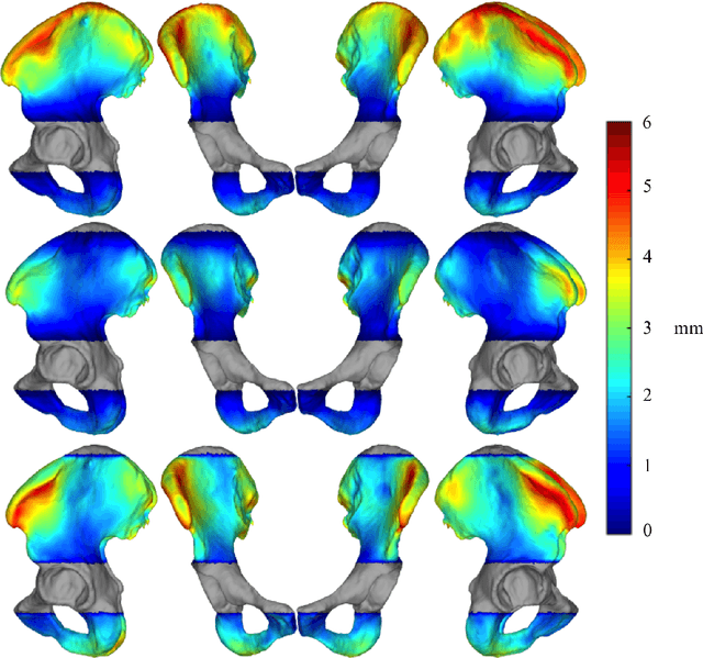 Figure 4 for Pelvis Surface Estimation From Partial CT for Computer-Aided Pelvic Osteotomies