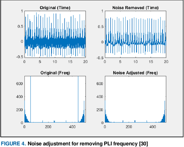 Figure 4 for A Machine Learning Framework for Biometric Authentication using Electrocardiogram