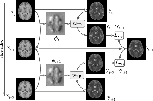 Figure 3 for Flow-based Deformation Guidance for Unpaired Multi-Contrast MRI Image-to-Image Translation