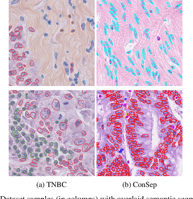 Figure 4 for Scale dependant layer for self-supervised nuclei encoding