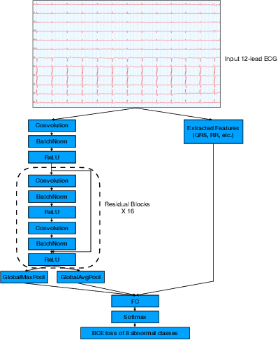Figure 1 for Diagnosing Cardiac Abnormalities from 12-Lead Electrocardiograms Using Enhanced Deep Convolutional Neural Networks