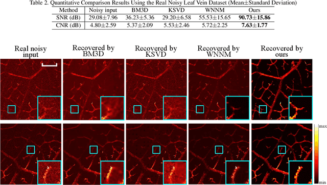 Figure 3 for De-Noising of Photoacoustic Microscopy Images by Deep Learning