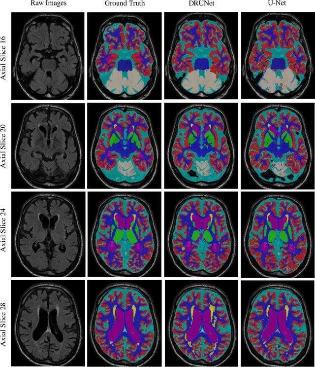 Figure 4 for Automatic Brain Structures Segmentation Using Deep Residual Dilated U-Net