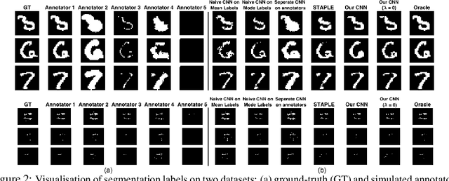 Figure 3 for Disentangling Human Error from the Ground Truth in Segmentation of Medical Images