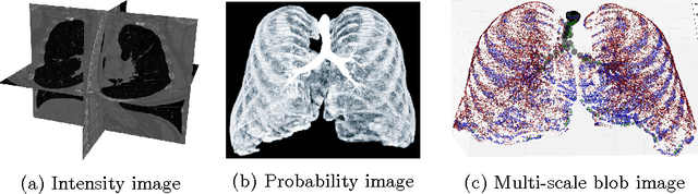 Figure 2 for Extraction of Airways with Probabilistic State-space Models and Bayesian Smoothing