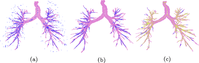 Figure 4 for Extraction of Airways with Probabilistic State-space Models and Bayesian Smoothing