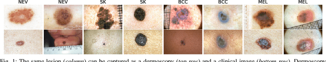 Figure 1 for Visual Diagnosis of Dermatological Disorders: Human and Machine Performance