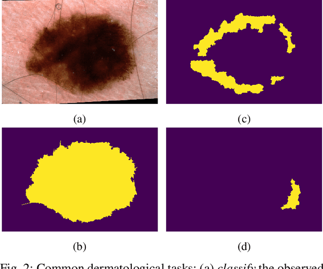 Figure 2 for Visual Diagnosis of Dermatological Disorders: Human and Machine Performance