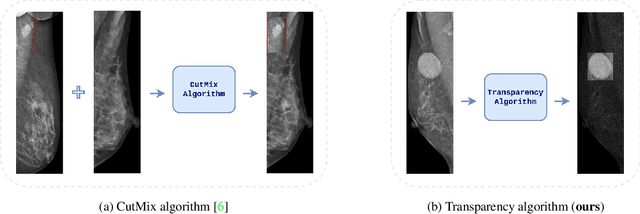Figure 3 for Transparency strategy-based data augmentation for BI-RADS classification of mammograms
