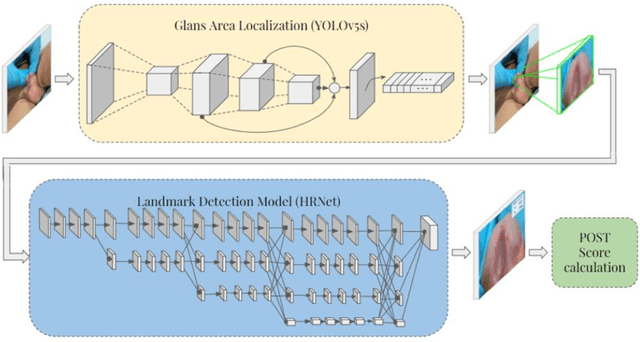 Figure 1 for Deep Learning based Automatic Quantification of Urethral Plate Quality using the Plate Objective Scoring Tool (POST)