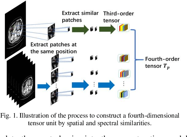 Figure 1 for Fourth-Order Nonlocal Tensor Decomposition Model for Spectral Computed Tomography