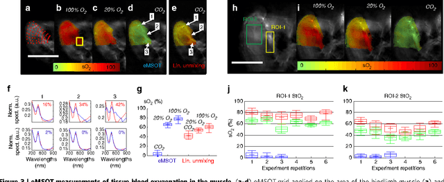 Figure 3 for Eigenspectra optoacoustic tomography achieves quantitative blood oxygenation imaging deep in tissues