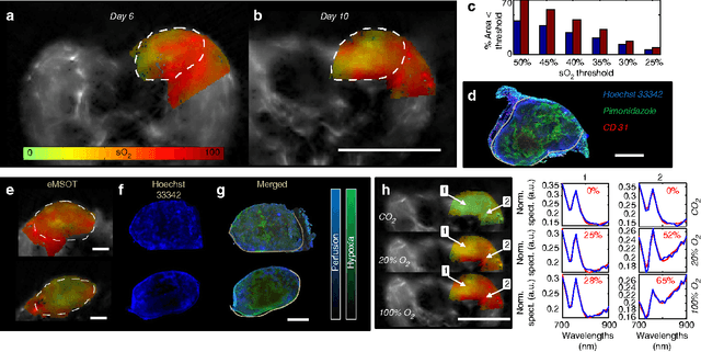 Figure 4 for Eigenspectra optoacoustic tomography achieves quantitative blood oxygenation imaging deep in tissues