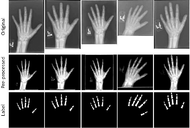 Figure 1 for Semi-Supervised Self-Taught Deep Learning for Finger Bones Segmentation