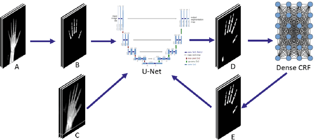 Figure 2 for Semi-Supervised Self-Taught Deep Learning for Finger Bones Segmentation