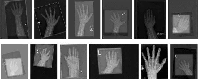 Figure 4 for Semi-Supervised Self-Taught Deep Learning for Finger Bones Segmentation