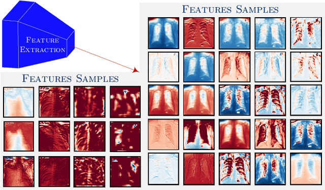 Figure 2 for GraphXCOVID: Explainable Deep Graph Diffusion Pseudo-Labelling for Identifying COVID-19 on Chest X-rays