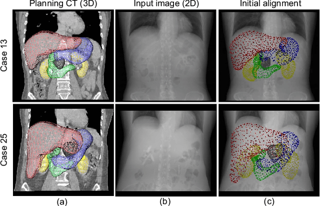 Figure 1 for IGCN: Image-to-graph Convolutional Network for 2D/3D Deformable Registration