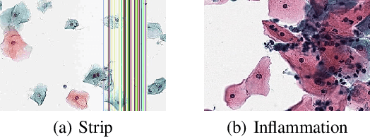 Figure 1 for Intrinsic Bias Identification on Medical Image Datasets
