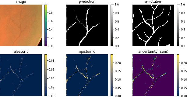 Figure 1 for Visualizing Uncertainty and Saliency Maps of Deep Convolutional Neural Networks for Medical Imaging Applications