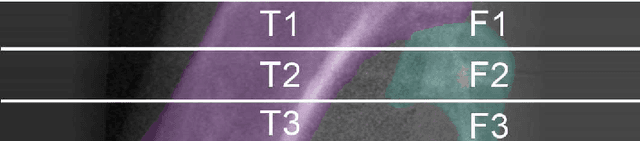 Figure 3 for Decoding the Rejuvenating Effects of Mechanical Loading on Skeletal Maturation using in Vivo Imaging and Deep Learning