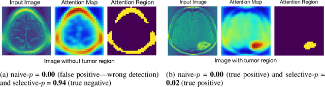 Figure 1 for Quantifying Statistical Significance of Neural Network Representation-Driven Hypotheses by Selective Inference