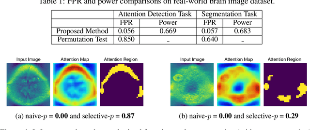 Figure 2 for Quantifying Statistical Significance of Neural Network Representation-Driven Hypotheses by Selective Inference