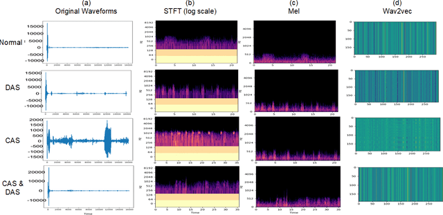 Figure 2 for Classify Respiratory Abnormality in Lung Sounds Using STFT and a Fine-Tuned ResNet18 Network