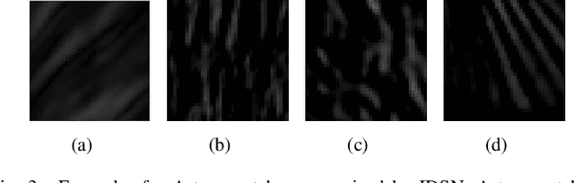 Figure 4 for "One-Shot" Reduction of Additive Artifacts in Medical Images
