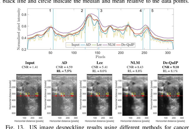 Figure 3 for A Novel Image Denoising Algorithm Using Concepts of Quantum Many-Body Theory