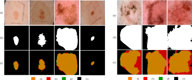 Figure 4 for MobileGAN: Skin Lesion Segmentation Using a Lightweight Generative Adversarial Network