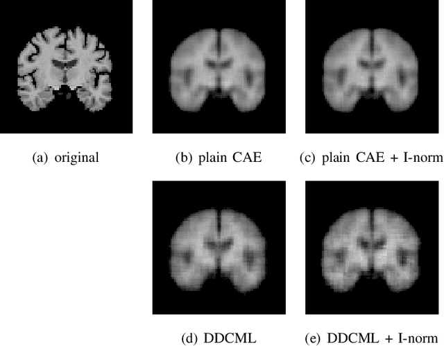 Figure 3 for Efficient feature embedding of 3D brain MRI images for content-based image retrieval with deep metric learning