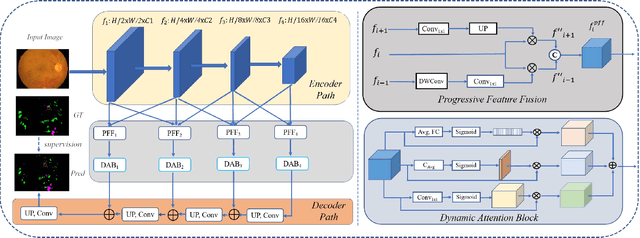 Figure 3 for Progressive Multi-scale Consistent Network for Multi-class Fundus Lesion Segmentation