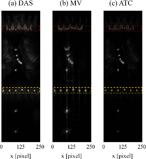 Figure 1 for Adaptive Time-Channel Beamforming for Time-of-Flight Correction