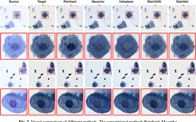 Figure 3 for StainNet: a fast and robust stain normalization network