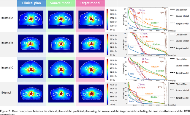 Figure 3 for Dose Prediction with Deep Learning for Prostate Cancer Radiation Therapy: Model Adaptation to Different Treatment Planning Practices