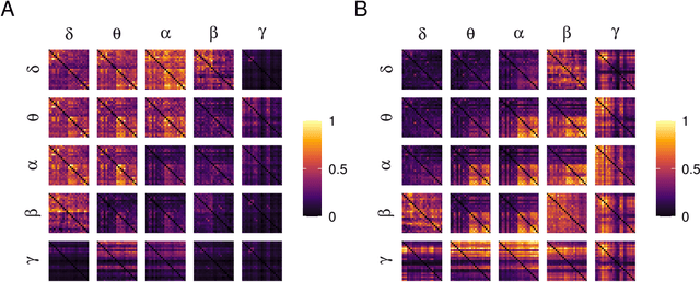 Figure 3 for Bispectrum-based Cross-frequency Functional Connectivity: Classification of Alzheimer's disease