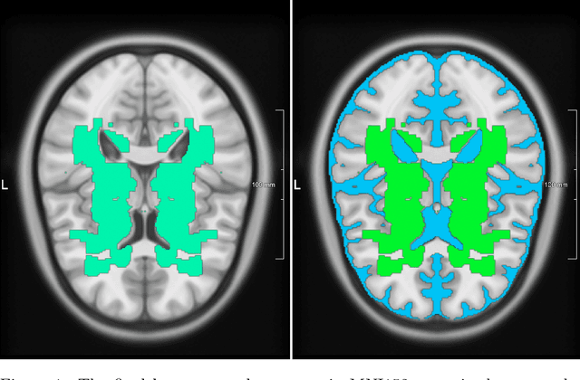 Figure 1 for MixLacune: Segmentation of lacunes of presumed vascular origin